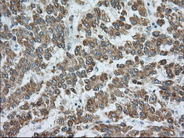 m07742 anti rab17 mouse monoclonal antibody clone id oti5e2 ihc testing 5
