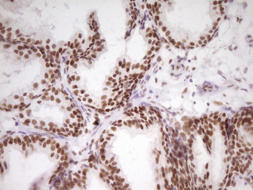 m07758 anti hmg20a mouse monoclonal antibody clone id oti2h4 ihc testing 10