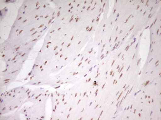 m07758 anti hmg20a mouse monoclonal antibody clone id oti2h4 ihc testing 11