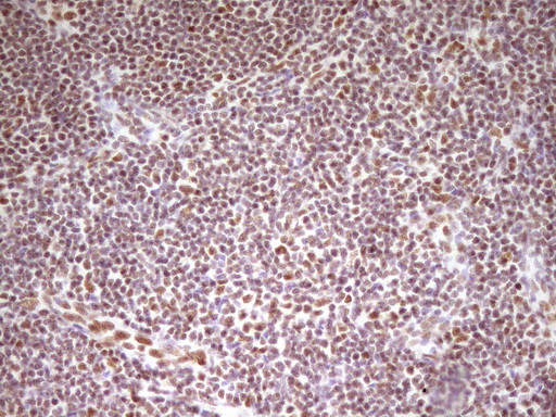 m07758 anti hmg20a mouse monoclonal antibody clone id oti2h4 ihc testing 12