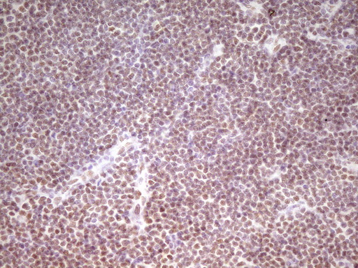 m07758 anti hmg20a mouse monoclonal antibody clone id oti2h4 ihc testing 13
