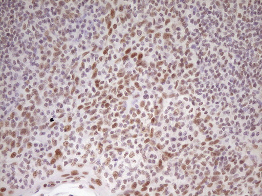 m07758 anti hmg20a mouse monoclonal antibody clone id oti2h4 ihc testing 14