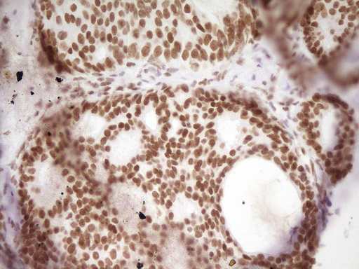 m07758 anti hmg20a mouse monoclonal antibody clone id oti2h4 ihc testing 15
