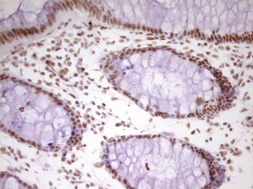 m07758 anti hmg20a mouse monoclonal antibody clone id oti2h4 ihc testing 16