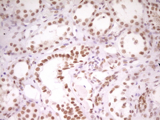 m07758 anti hmg20a mouse monoclonal antibody clone id oti2h4 ihc testing 17