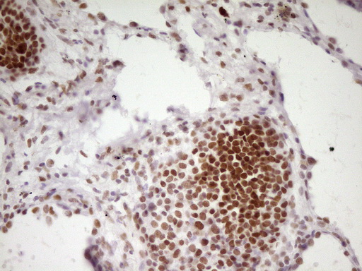 m07758 anti hmg20a mouse monoclonal antibody clone id oti2h4 ihc testing 18