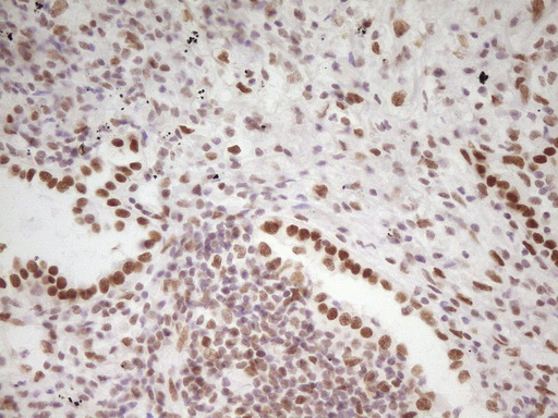 m07758 anti hmg20a mouse monoclonal antibody clone id oti2h4 ihc testing 2