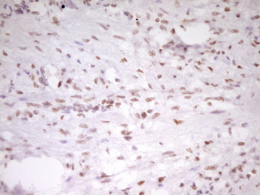 m07758 anti hmg20a mouse monoclonal antibody clone id oti2h4 ihc testing 3