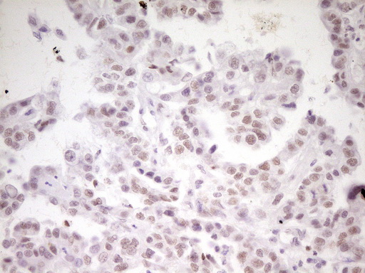 m07758 anti hmg20a mouse monoclonal antibody clone id oti2h4 ihc testing 4