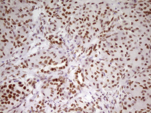 m07758 anti hmg20a mouse monoclonal antibody clone id oti2h4 ihc testing 5