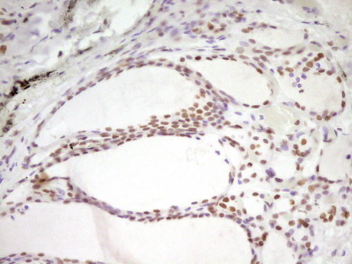 m07758 anti hmg20a mouse monoclonal antibody clone id oti2h4 ihc testing 6