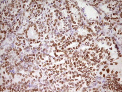m07758 anti hmg20a mouse monoclonal antibody clone id oti2h4 ihc testing 7