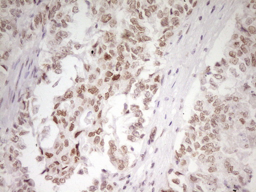 m07758 anti hmg20a mouse monoclonal antibody clone id oti2h4 ihc testing 8
