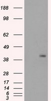 HEK293T cells were transfected with the pCMV6-ENTRY control (Left lane) or pCMV6-ENTRY PPP1R7 (Right lane) cDNA for 48 hrs and lysed. Equivalent amounts of cell lysates (5 ug per lane) were separated by SDS-PAGE and immunoblotted with anti-PPP1R7.