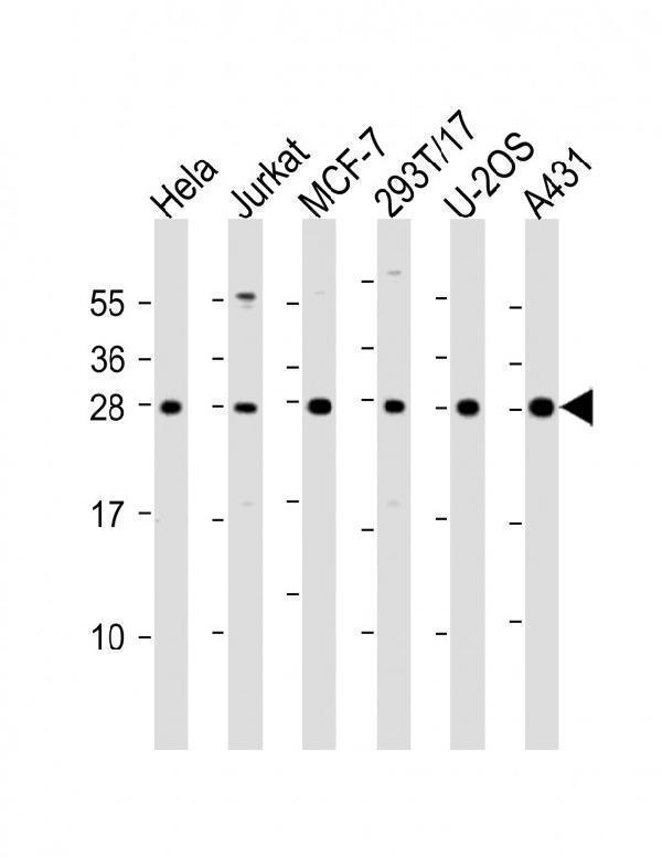 m07781 anti rpl14 antibody center wb testing 2