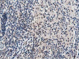 m07788 anti dpp3 mouse monoclonal antibody clone id oti2d9 ihc testing 10