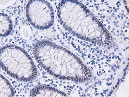 m07788 anti dpp3 mouse monoclonal antibody clone id oti2d9 ihc testing 11
