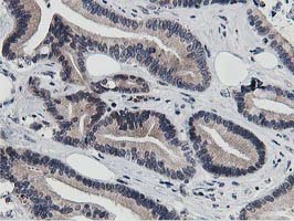 m07788 anti dpp3 mouse monoclonal antibody clone id oti2d9 ihc testing 12