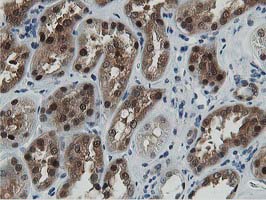m07788 anti dpp3 mouse monoclonal antibody clone id oti2d9 ihc testing 13