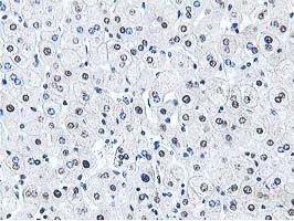 m07788 anti dpp3 mouse monoclonal antibody clone id oti2d9 ihc testing 14