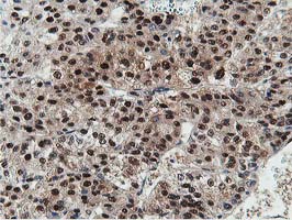 m07788 anti dpp3 mouse monoclonal antibody clone id oti2d9 ihc testing 15