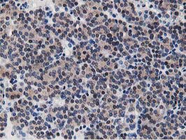m07788 anti dpp3 mouse monoclonal antibody clone id oti2d9 ihc testing 4