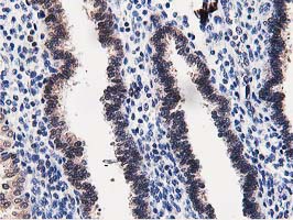 m07788 anti dpp3 mouse monoclonal antibody clone id oti2d9 ihc testing 5
