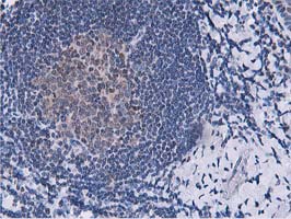 m07788 anti dpp3 mouse monoclonal antibody clone id oti2d9 ihc testing 9