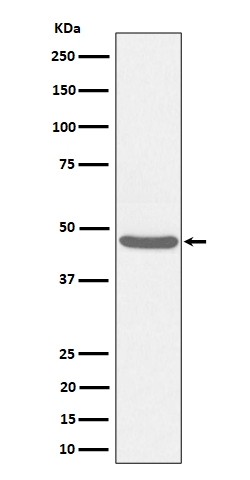 Western blot analysis of BCKDK expression in HeLa cell lysate