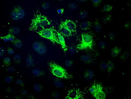 m07798 anti bckdh kinase bckdk mouse monoclonal antibody clone id oti11c9 if testing 4