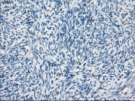 Immunohistochemical staining of paraffin-embedded Human Ovary tissue within the normal limits using anti-BCKDK mouse monoclonal antibody
