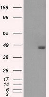 HEK293T cells were transfected with the pCMV6-ENTRY control (Left lane) or pCMV6-ENTRY BCKDK (Right lane) cDNA for 48 hrs and lysed