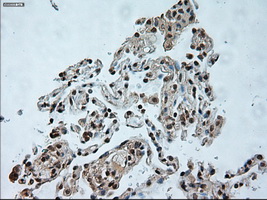 m07816 1 anti usp13 mouse monoclonal antibody clone id oti4g11 ihc testing 12