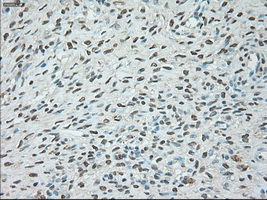 Immunohistochemical staining of paraffin-embedded Ovary tissue within the normal limits using anti-USP13mouse monoclonal antibody