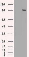 HEK293T cells were transfected with the pCMV6-ENTRY control (Left lane) or pCMV6-ENTRY USP13 (Right lane) cDNA for 48 hrs and lysed