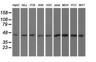 m07817 1 anti kist uhmk1 mouse monoclonal antibody clone id oti5e10 wb testing 2