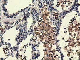 m07817 anti kist uhmk1 mouse monoclonal antibody clone id oti2h4 ihc testing 3