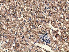 m07817 anti kist uhmk1 mouse monoclonal antibody clone id oti2h4 ihc testing 4