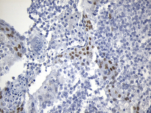 Immunohistochemical staining of paraffin-embedded Human tonsil within the normal limits using anti-OIP5 mouse monoclonal antibody
