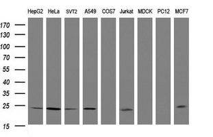 Western blot analysis of extracts (35ug) from 9 different cell lines by usin g anti-RIT2 monoclonal antibody (HepG2: human; HeLa: human; SVT2: mouse; A549: human; COS7: monkey; Jurkat: human; MDCK: canine; PC12: rat; MCF7: human)