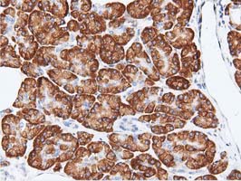 m07833 anti rit2 mouse monoclonal antibody clone id oti3f4 ihc testing 4