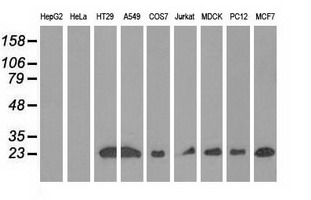 m07833 anti rit2 mouse monoclonal antibody clone id oti3f4 wb testing 2