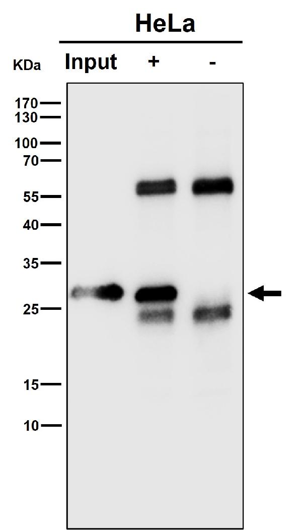 Immunoprecipitate (IP) analysis using the Antibody at 1:50 dilution. (wb at 1:1K dilution)