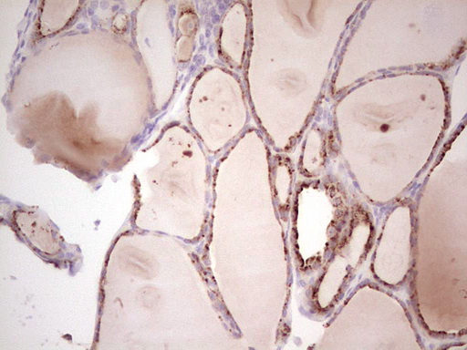 Immunohistochemical staining of paraffin-embedded Human thyroid tissue within the normal limits using anti-SENP8 mouse monoclonal antibody