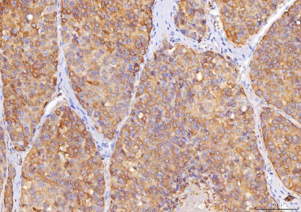 m07851 1 sord primary antibodies ihc testing 2