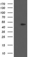 HEK293T cells were transfected with the pCMV6-ENTRY control (Left lane) or pCMV6-ENTRY PHKG2 (Right lane) cDNA for 48 hrs and lysed