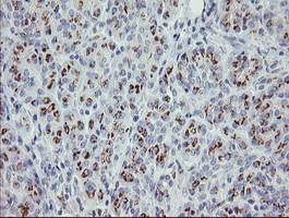 Immunohistochemical staining of paraffin-embedded Human pancreas tissue within the normal limits using anti-PHKG2 mouse monoclonal antibody