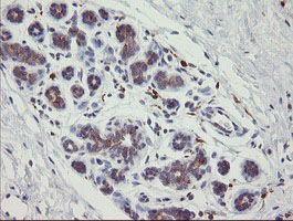 m07871 anti phkg2 mouse monoclonal antibody clone id oti1f9 ihc testing 4
