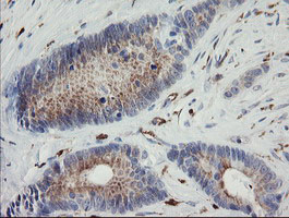 m07871 anti phkg2 mouse monoclonal antibody clone id oti1f9 ihc testing 5