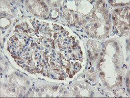 m07871 anti phkg2 mouse monoclonal antibody clone id oti1f9 ihc testing 6